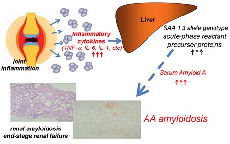 aaa+ protein|al vs aa amyloidosis.